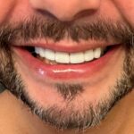 SMILE HARDER- GET INFECTED